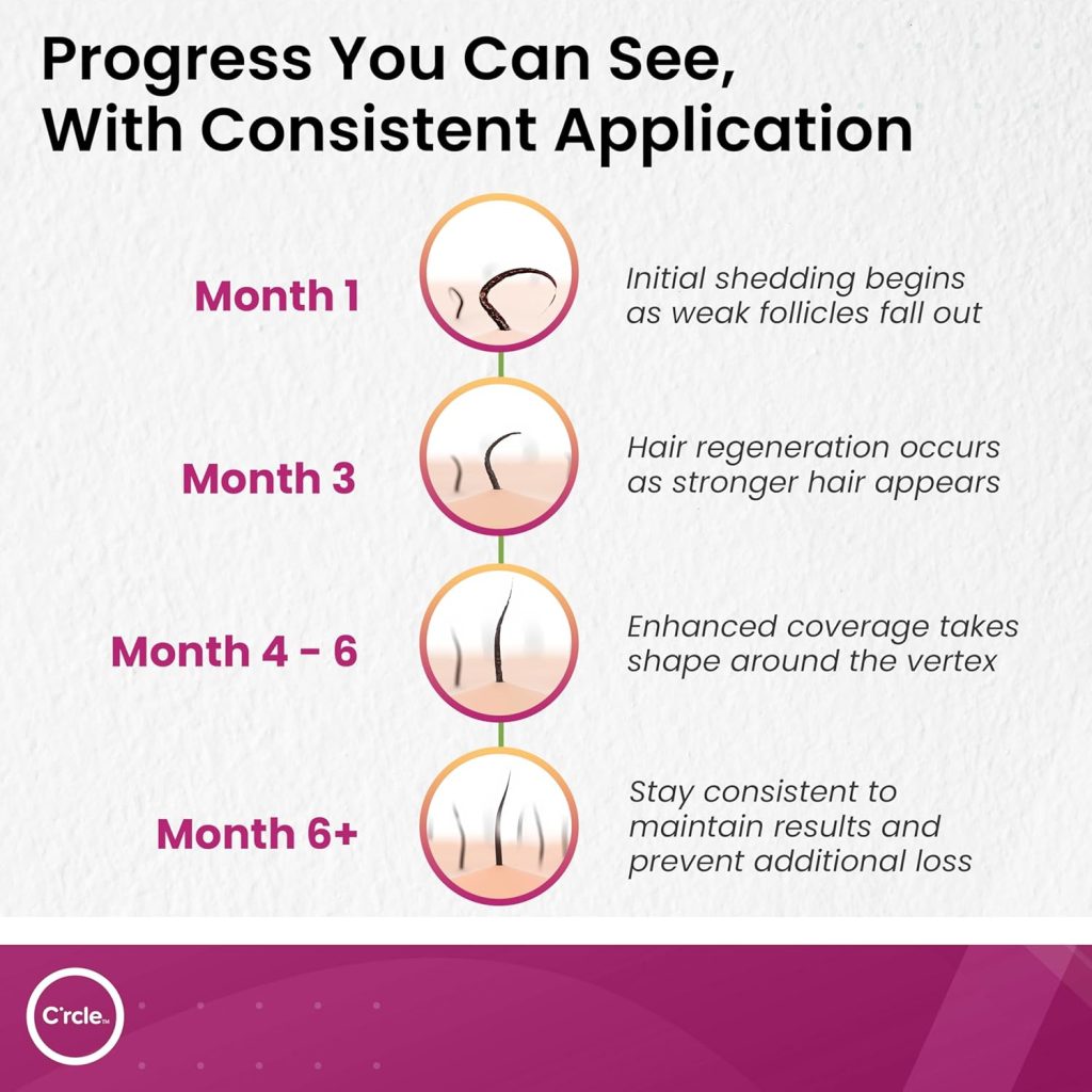 C'rcle Minoxidil 5% Foam for Women Review