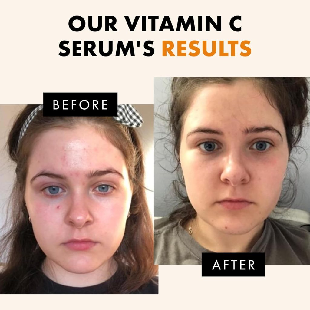 A lightweight Vitamin C serum designed to brighten dull skin, reduce early signs of aging, and restore confidence. Ideal for daily use, even in humid climates.