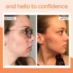 Sapi Anito 8in1, Face Serum Vitamin C, Niacinamide, Collagen, Kojic Acid, Turmeric, Vitamin E, Hyaluronic Acid, Retinol, Skin Care, Facial Moisturizer, Hydrating Serum, Targets Wrinkles,1 fl oz.