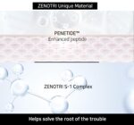 Biotin and Zinc Pyrithione Shampoo - Combats Itching, Dandruff, Seborrhoeic Dermatitis & Sebum Buildup | Scalp Care Solution | 300ml 10 oz