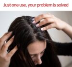 Biotin and Zinc Pyrithione Shampoo - Combats Itching, Dandruff, Seborrhoeic Dermatitis & Sebum Buildup | Scalp Care Solution | 300ml 10 oz