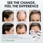 Micro Infusion Hair Regrowth System – Hair Growth Treatment with Ginseng, He Shou Wu, Angelica & Hyaluronic Acid, Thickening Serum for Fuller, Stronger Hair – Premium Scalp & Hair Care for Men & Women