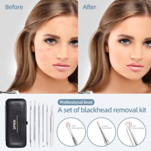 JPNK Blackhead Remover Kit – Professional Acne Extractor Tools