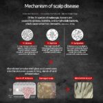 Biotin and Zinc Pyrithione Shampoo - Combats Itching, Dandruff, Seborrhoeic Dermatitis & Sebum Buildup | Scalp Care Solution | 300ml 10 oz