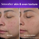 Olay Retinol Night Cream for Women, Anti-Aging Face Moisturizer, Fragrance-Free, Gift for Women, Non Greasy - Anti-Wrinkle, Hydrating Skin Care - Triple Collagen Cream, Peptide, Niacinamide, 1.7oz