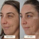 Aeki Lymphatic Contour Face Brush – Reduce Puffiness & Sculpt Naturally | LoookNow