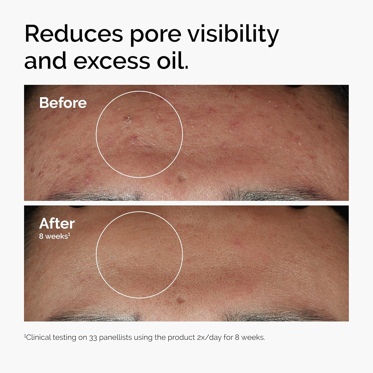 The Ordinary Niacinamide 10% + Zinc 1% Review
