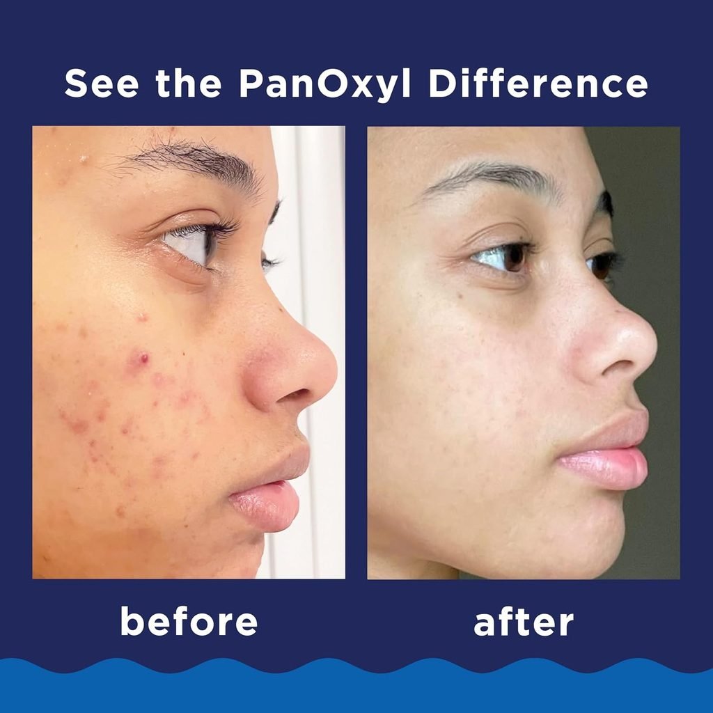 Panoxyl 7