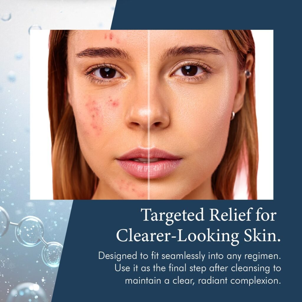 SkinPro Blemish Treatment 7